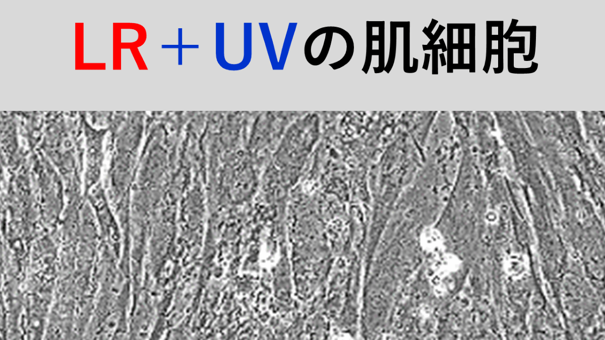 LRによる細胞保護