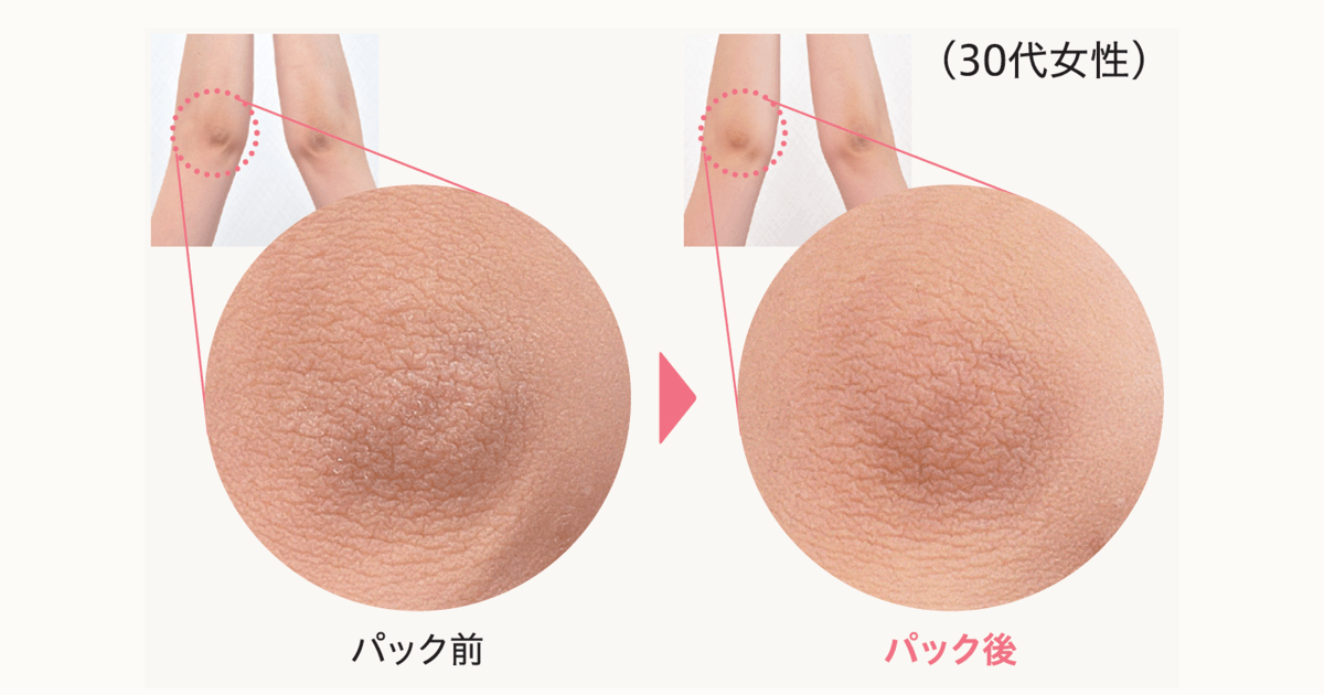 シートパックの使用前後比較