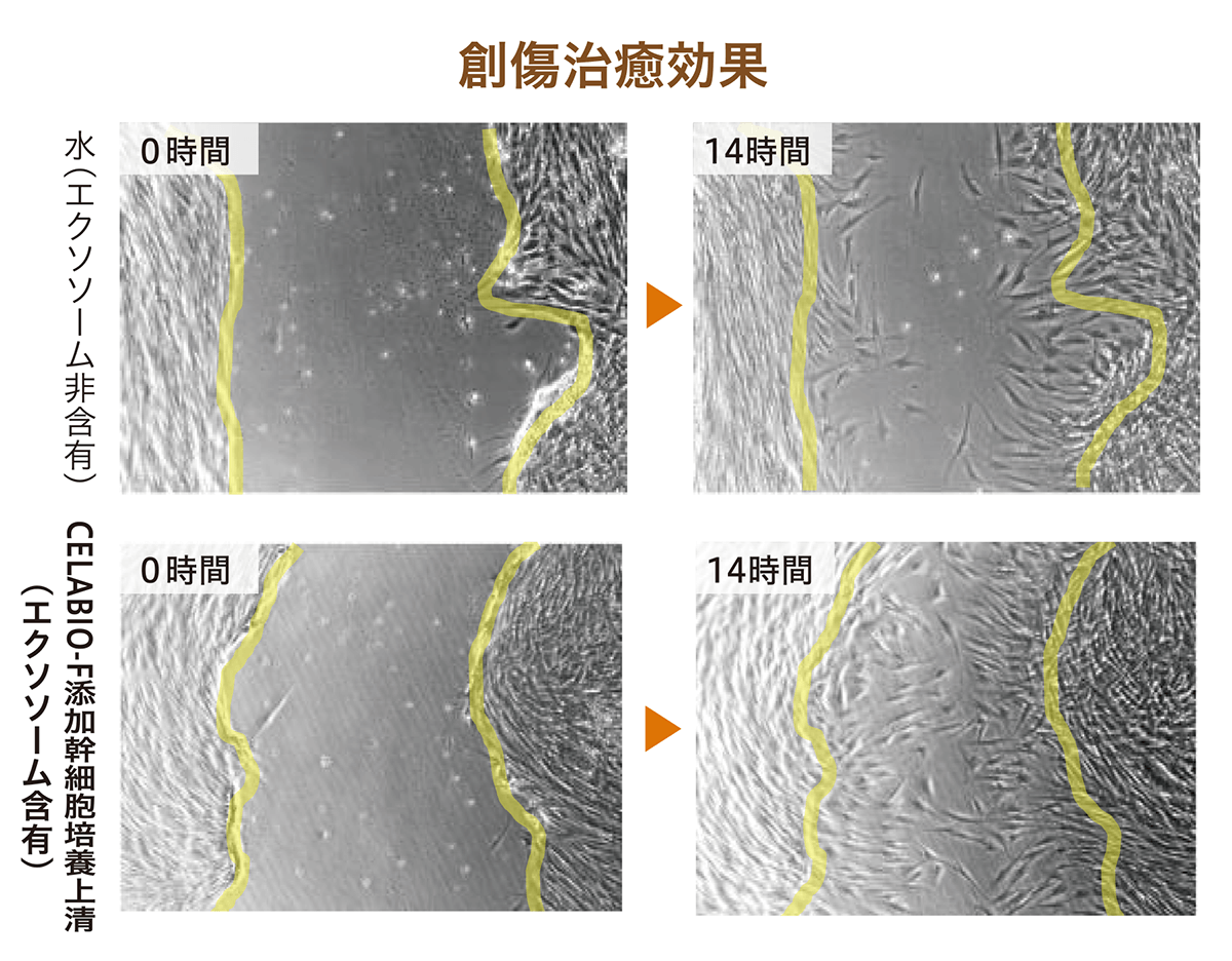 CELABIO®-Fによる創傷治癒効果